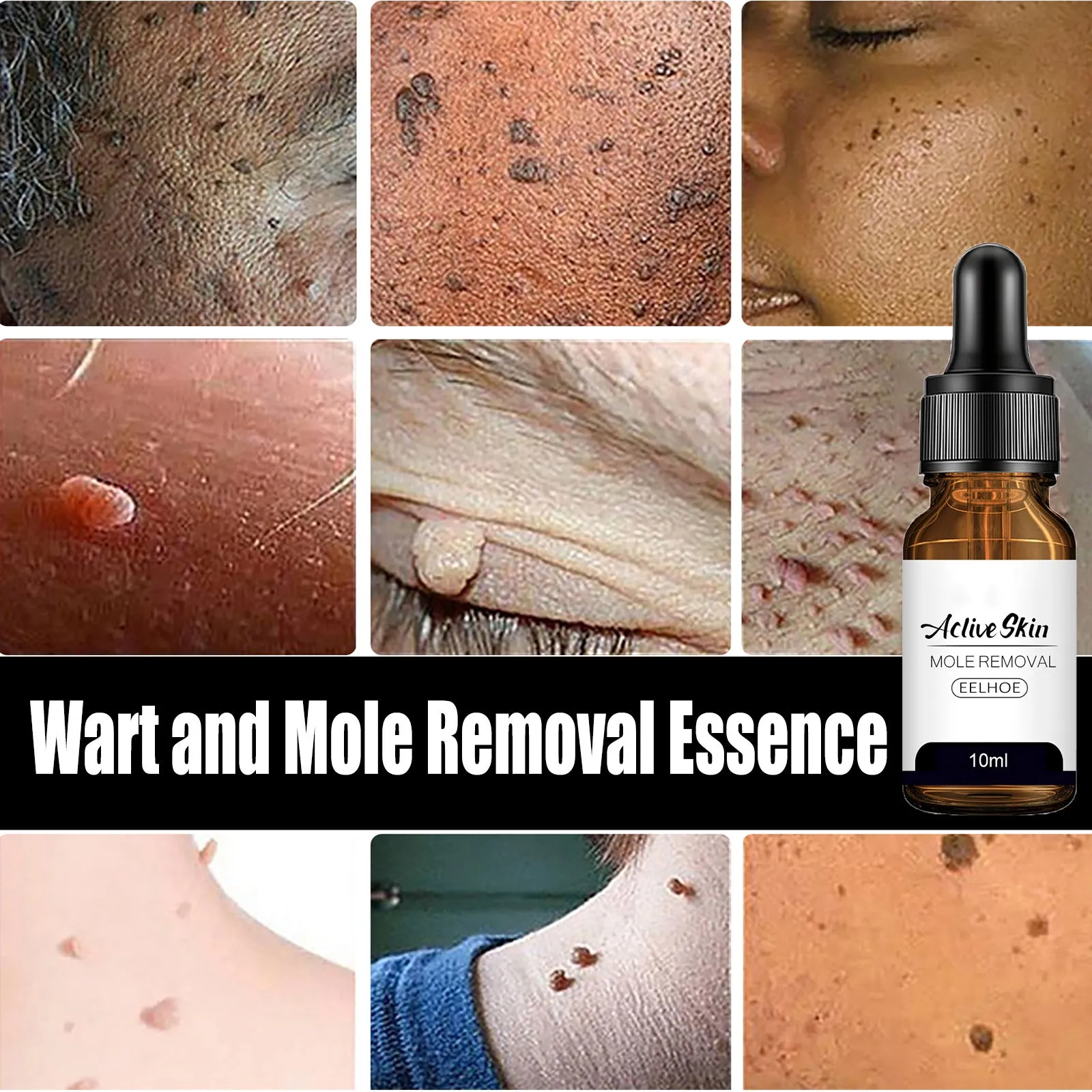 Mole Removal Wart Essence Skin Removal Facial Armpit Flesh Bump Repair Cleaning Care